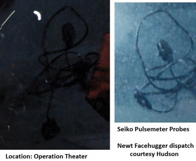 Operation Theater Pulsemeter Probes.jpg